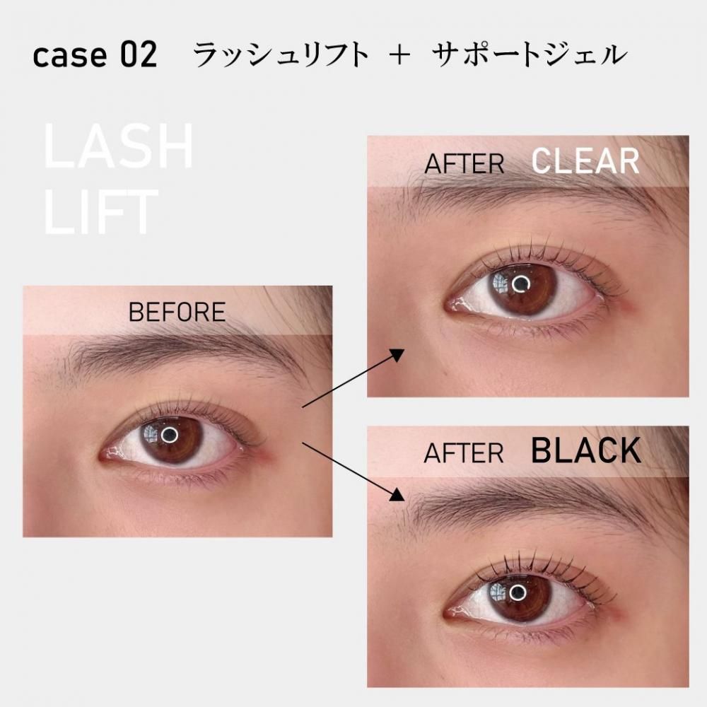 フェニックスアイ アイラッシュサポートジェル ザ ブラック フェニックス アイラッシュサポートジェル ザ ブラックの販売ページ